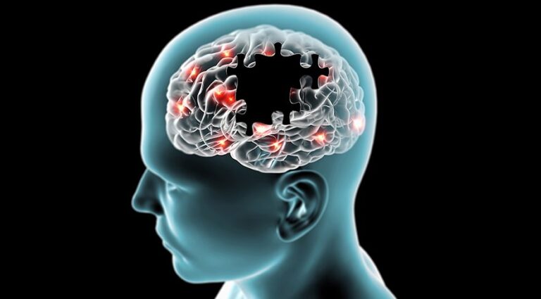 Alzheimer Hastalığı